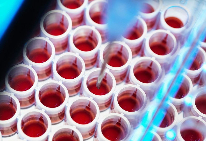 Тело в доброе дело: 3 простых способа стать донором