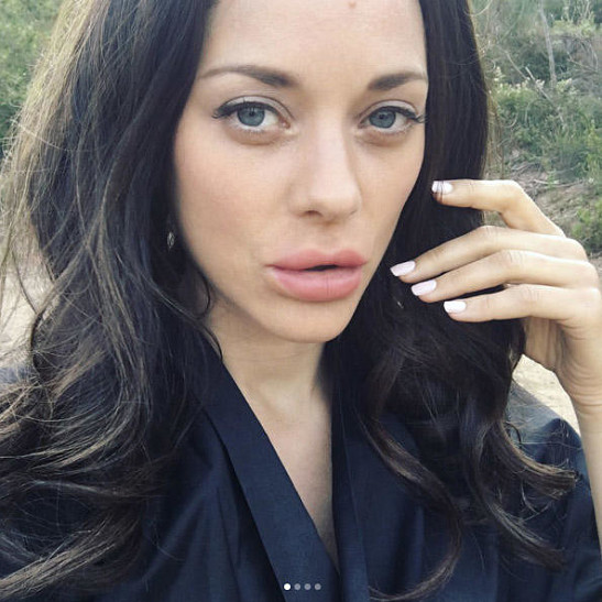 Марион Котийяр увеличила губы