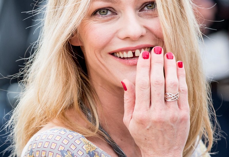 10 звезд, которые не стесняются говорить о недостатках своей внешности