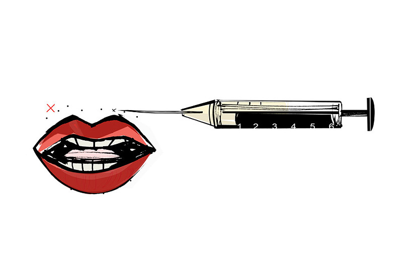 3 аргумента не в пользу контурной пластики губ