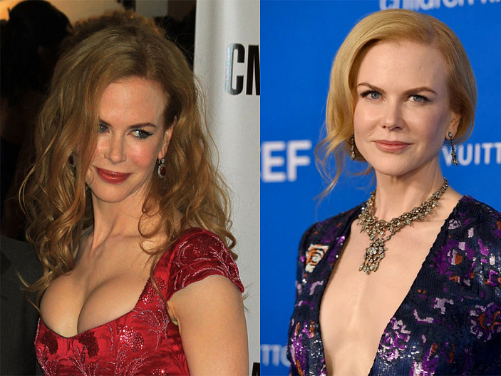 Николь Кидман