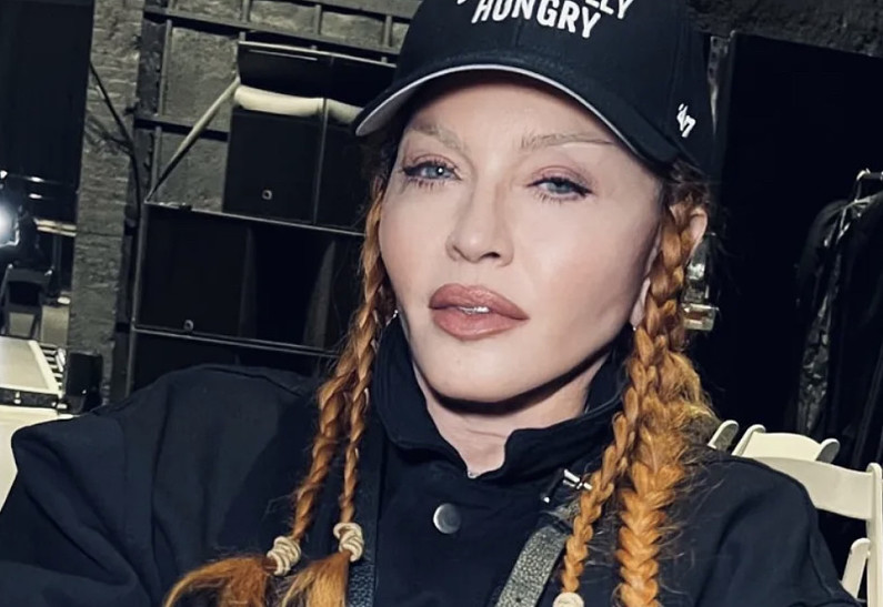 Мадонна показала лицо после пластической операции. Фото!