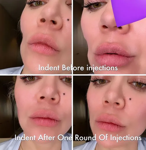 Хлои Кардашьян