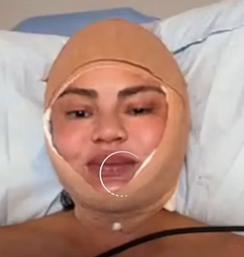 Крисси Тейген