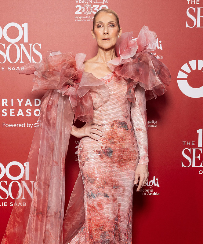 Селин Дион сделала важный шаг в своей карьере на фоне борьбы с синдромом скованности