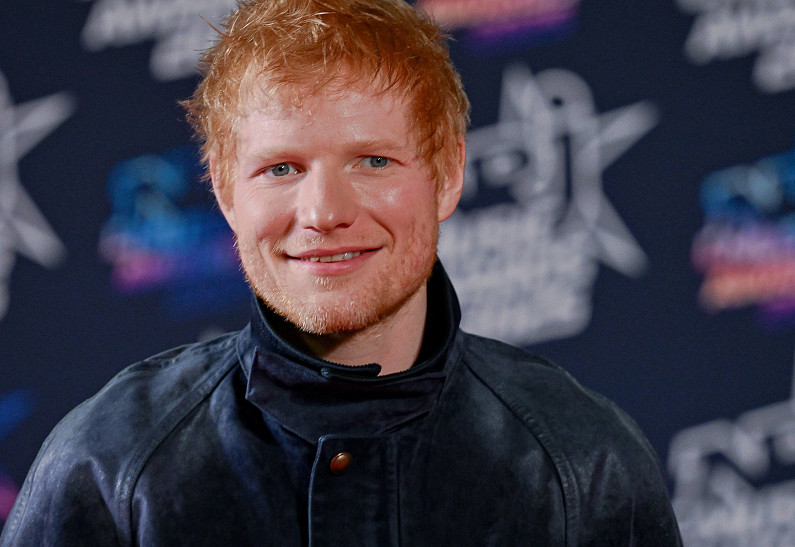 Эд Ширан шокировал фанатов бритой головой